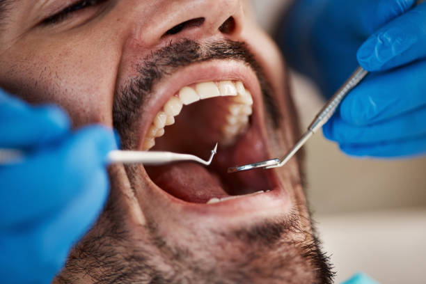 Best Orthodontic Emergency Dentist in Fairview Park, OH