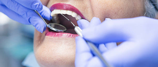 Best Emergency Dentist for Special Needs Patients in Fairview Park, OH
